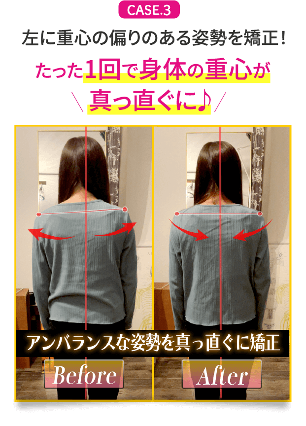 CASE.3 左に重心の偏りのある姿勢を矯正！たった1回で身体の重心が真っ直ぐに♪